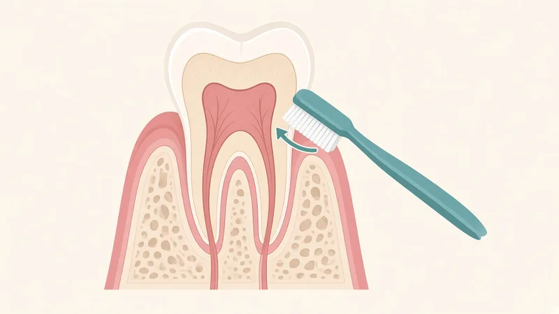 Illustration of a soft-bristled toothbrush angled against the gumline of a tooth cross-section with a curved arrow