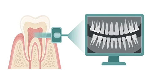Clinical illustration of a tooth cross-section with an x-ray sensor, linked to a computer screen showing a digital dental x-ray