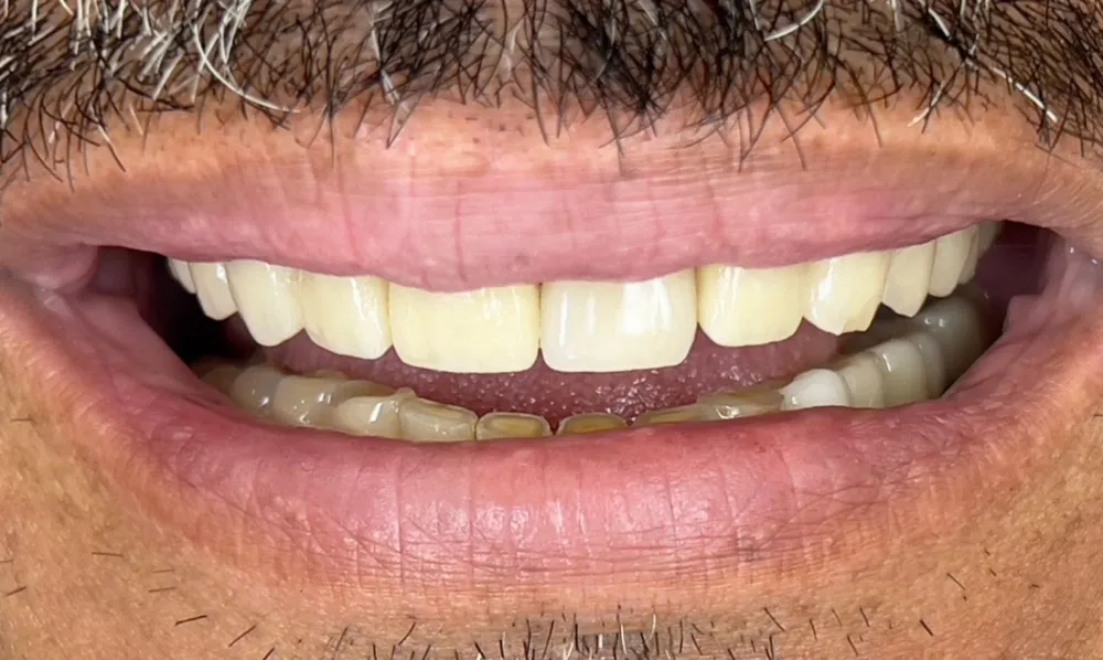 Before-and-after dental treatment photo 12