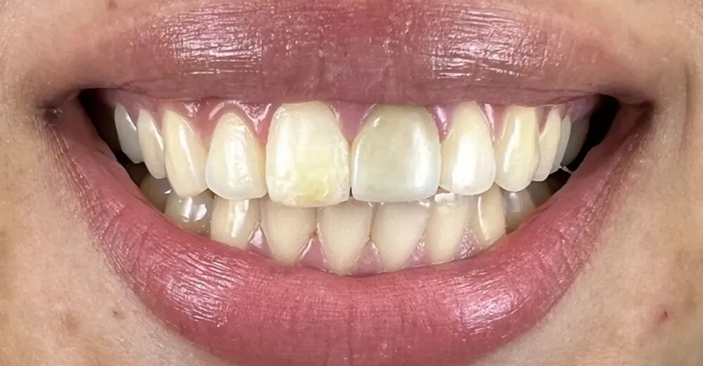Before-and-after dental treatment photo 1