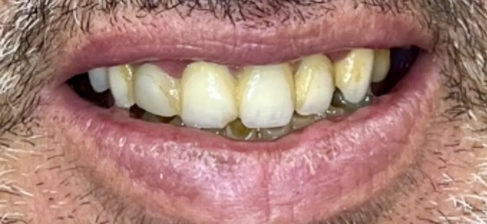 Before-and-after dental treatment photo 5