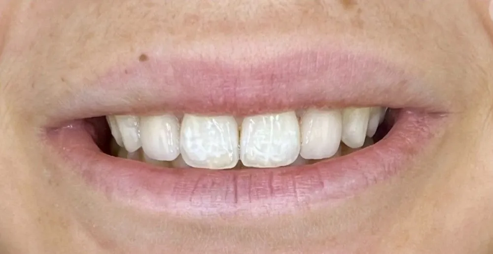Before-and-after dental treatment photo 8