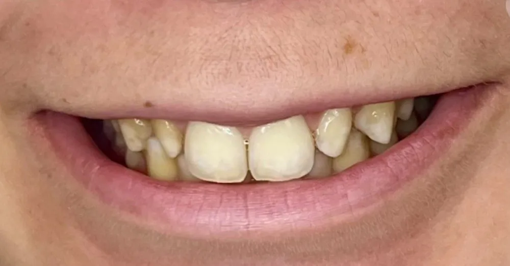 Before-and-after dental treatment photo 7