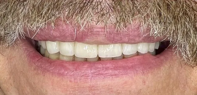 Before-and-after dental treatment photo 10