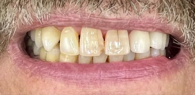 Before-and-after dental treatment photo 9